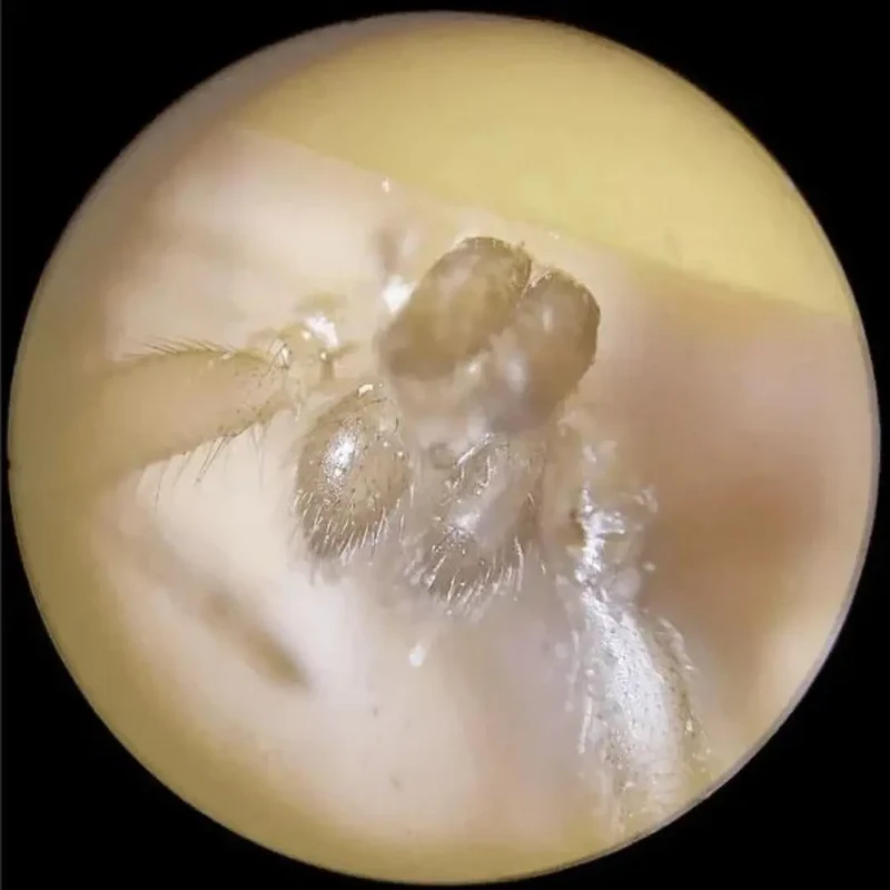 Microscope de poche - The Little Scope™